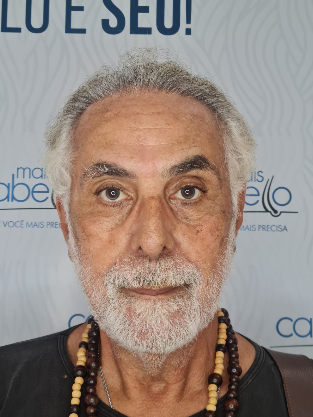 Anselmo Vasconcellos, paciente Mais Cabello