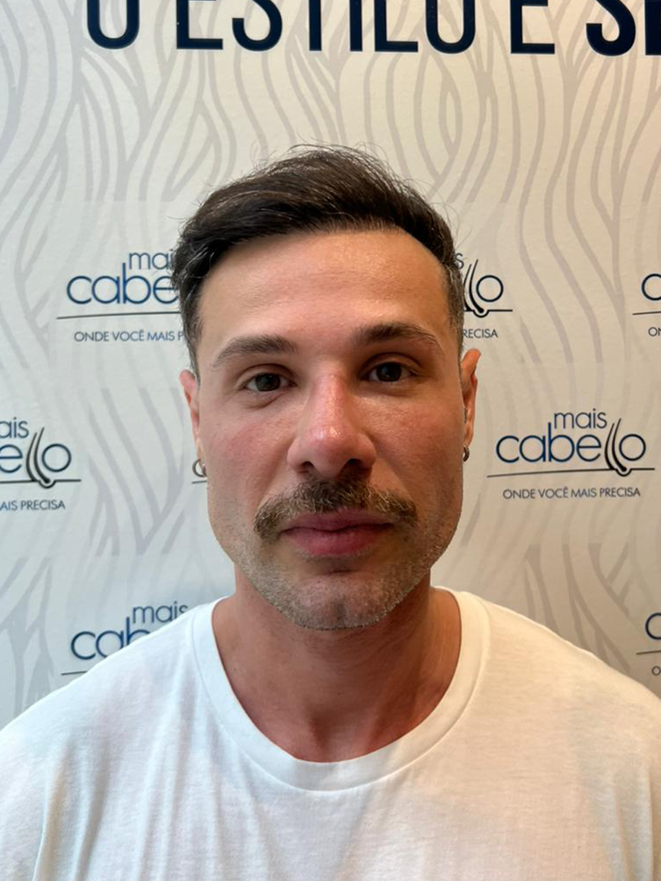 Alex Galette, paciente Mais Cabello