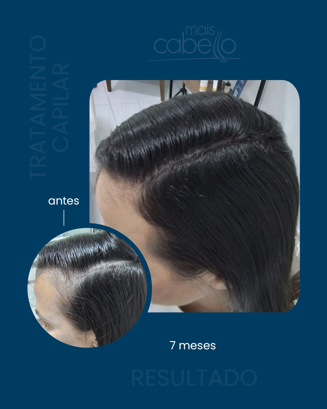 Resultado de Protocolo Capilar feminino — Mais Cabello Uberlândia